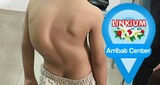 Image d'un dos déformé par un mauvais cartable